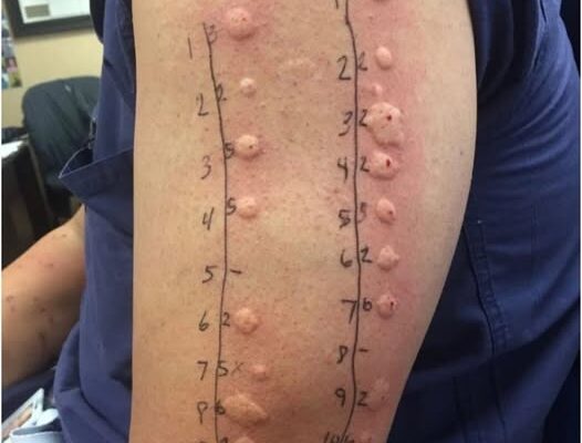 These are the consequences of sleeping with the…